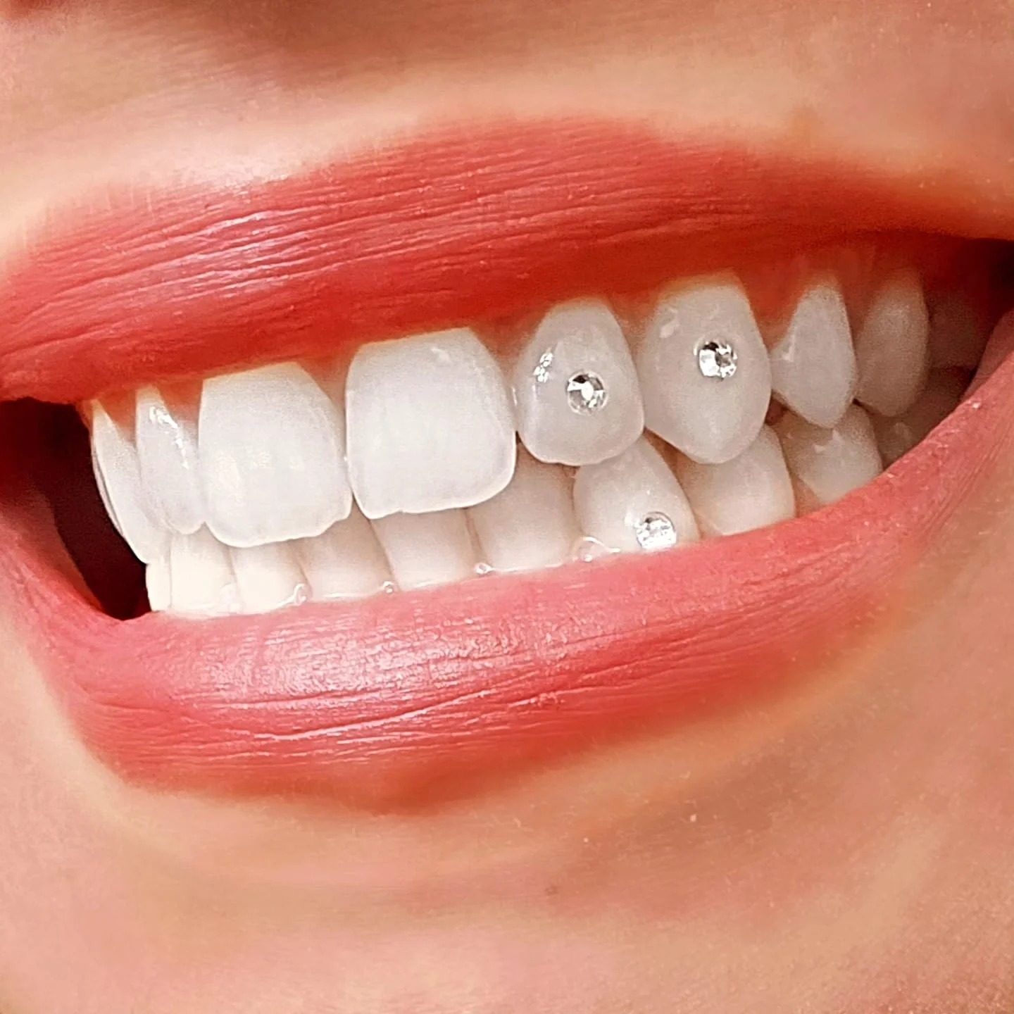 Tooth Jewellery